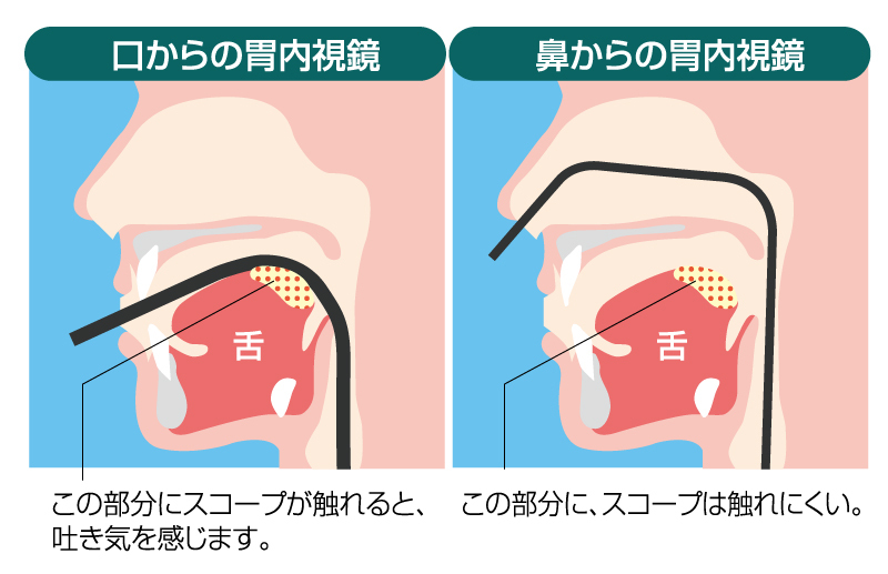 胃内視鏡鼻と口イラスト