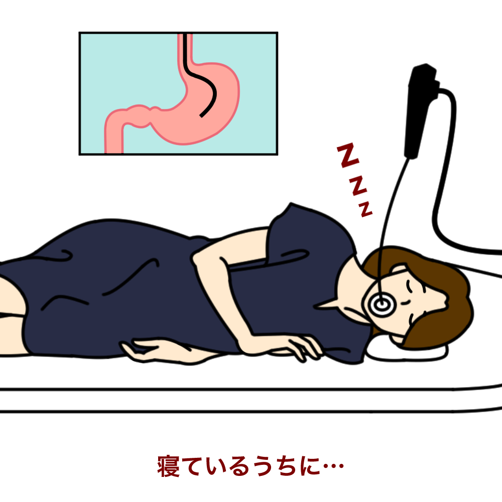鎮静内視鏡イラスト